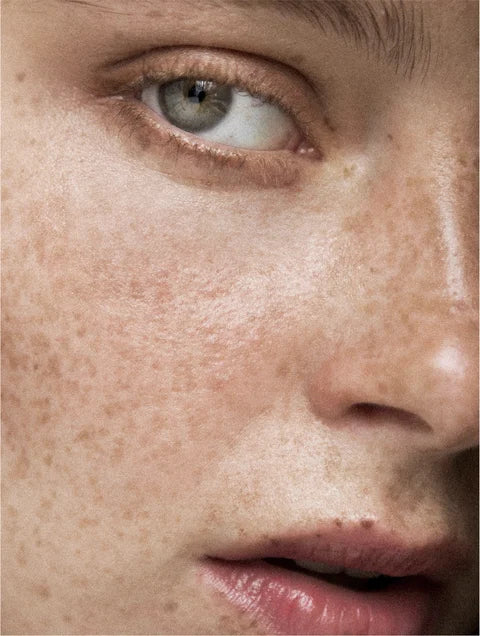 Close-up of a person's face with freckles and a green eye.